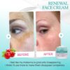 SAAM Face CreamSaam  Renewal